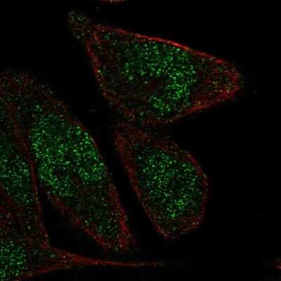 Immunocytochemistry/ Immunofluorescence: ZNF610 Antibody [NBP2-69061]