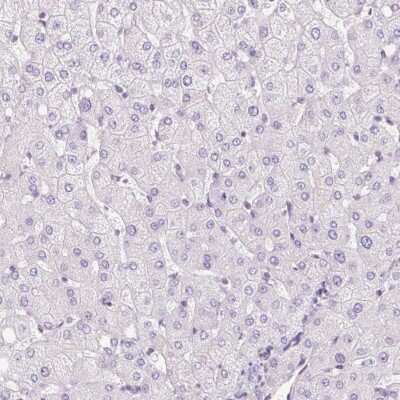 Immunohistochemistry-Paraffin: ZNF610 Antibody [NBP2-49192]