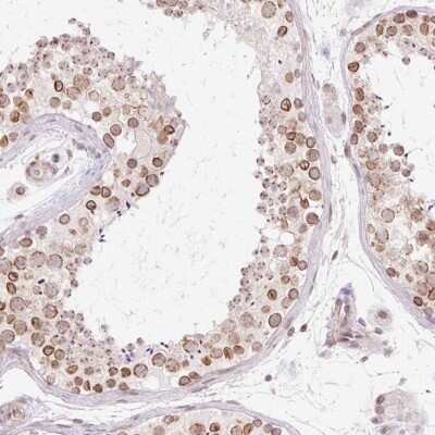 Immunohistochemistry-Paraffin: ZNF610 Antibody [NBP2-49192]