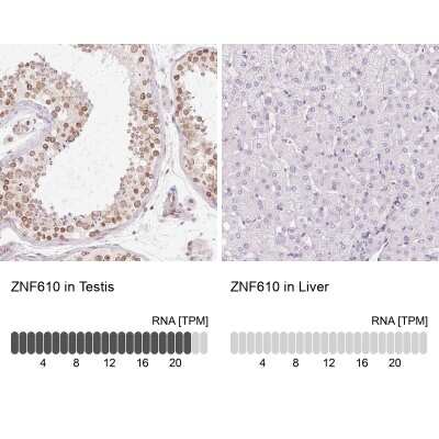 Immunohistochemistry-Paraffin: ZNF610 Antibody [NBP2-49192]