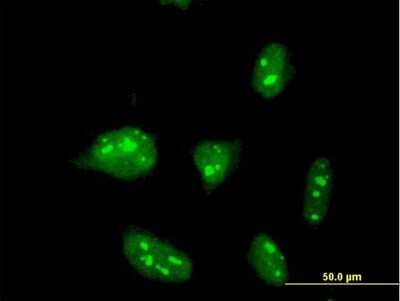 Immunocytochemistry/ Immunofluorescence: ZNF611 Antibody (4F1) [H00081856-M04]