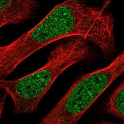 Immunocytochemistry/ Immunofluorescence: ZNF613 Antibody [NBP1-82250]