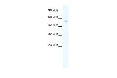 Western Blot: ZNF613 Antibody [NBP2-83884]