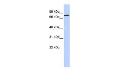 Western Blot: ZNF613 Antibody [NBP2-83885]