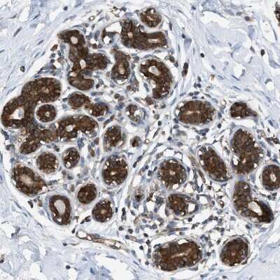 Immunohistochemistry-Paraffin: ZNF614 Antibody [NBP1-82133]