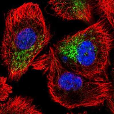 Immunocytochemistry/ Immunofluorescence: ZNF615 Antibody [NBP2-13587]