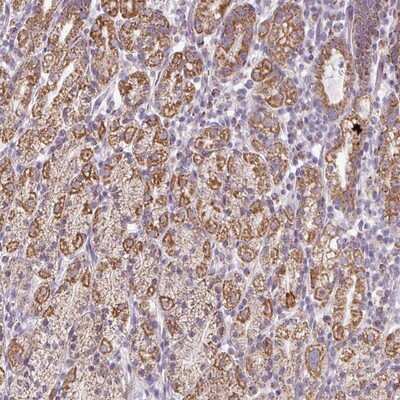 Immunohistochemistry-Paraffin: ZNF615 Antibody [NBP2-13587]