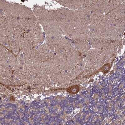 Immunohistochemistry-Paraffin: ZNF618 Antibody [NBP1-92635]
