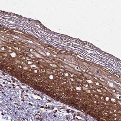 Immunohistochemistry-Paraffin: ZNF618 Antibody [NBP1-92635]