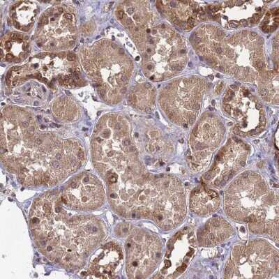 Immunohistochemistry-Paraffin: ZNF618 Antibody [NBP1-92635]