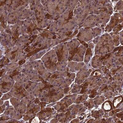 Immunohistochemistry-Paraffin: ZNF618 Antibody [NBP1-92635]