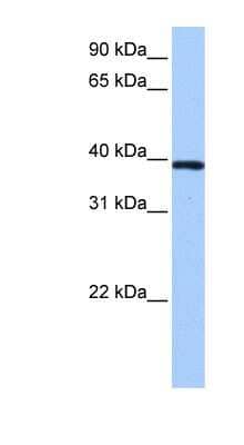 Western Blot: ZNF618 Antibody [NBP1-79410]