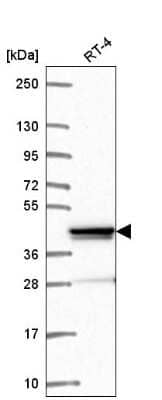 Western Blot: ZNF618 Antibody [NBP2-57450]