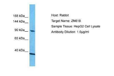 Western Blot: ZNF618 Antibody [NBP2-88716]