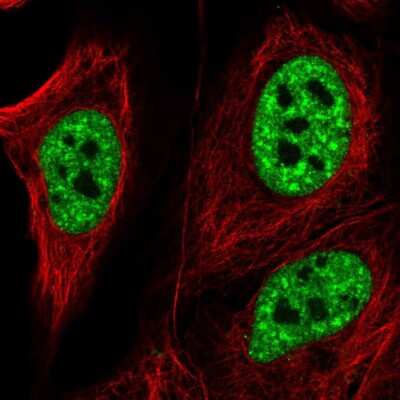 Immunocytochemistry/ Immunofluorescence: ZNF621 Antibody [NBP2-56492]