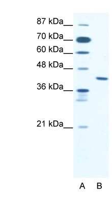 Western Blot: ZNF621 Antibody [NBP1-80005]