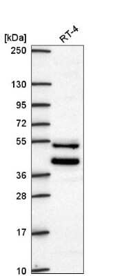 Western Blot: ZNF621 Antibody [NBP2-56433]