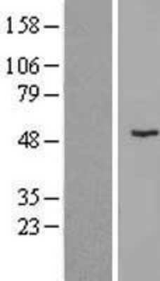 Western Blot: ZNF621 Overexpression Lysate [NBL1-18210]