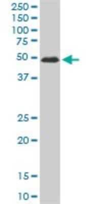 Western Blot: ZNF622 Antibody (3C5) [H00090441-M02]