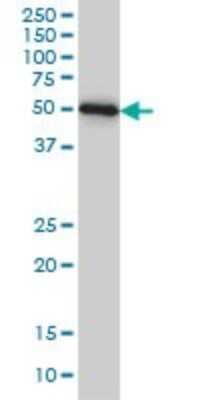 Western Blot: ZNF622 Antibody (3C5) [H00090441-M02]