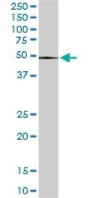 Western Blot: ZNF622 Antibody (3C5) [H00090441-M02]