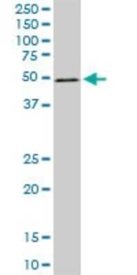 Western Blot: ZNF622 Antibody (3C5) [H00090441-M02]