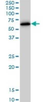 Western Blot: ZNF622 Antibody (3C5) [H00090441-M02]