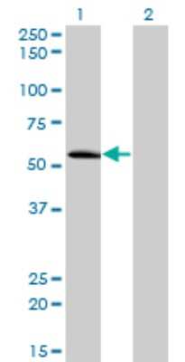 Western Blot: ZNF622 Antibody (3C5) [H00090441-M02]