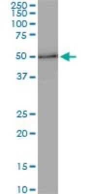 Western Blot: ZNF622 Antibody (4G6) [H00090441-M01]