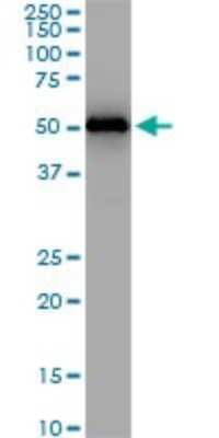Western Blot: ZNF622 Antibody (4G6) [H00090441-M01]