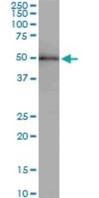 Western Blot: ZNF622 Antibody (4G6) [H00090441-M01]