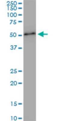 Western Blot: ZNF622 Antibody (4G6) [H00090441-M01]