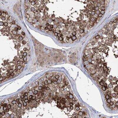 Immunohistochemistry: ZNF622 Antibody [NBP1-81183]