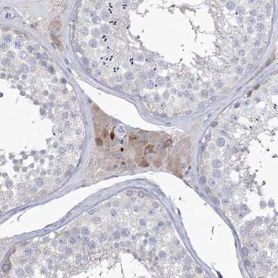 Immunohistochemistry-Paraffin: ZNF622 Antibody [NBP2-38307]