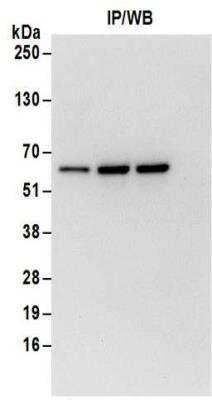 Immunoprecipitation: ZNF622 Antibody [NBP2-32087]