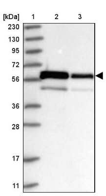 Western Blot: ZNF622 Antibody [NBP1-81183]