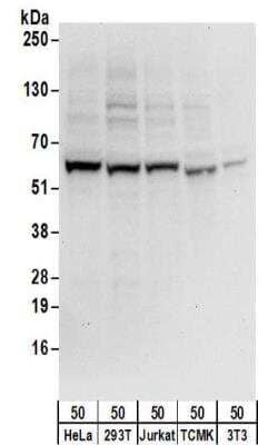 Western Blot: ZNF622 Antibody [NBP2-32087]