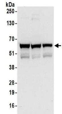 Western Blot: ZNF622 Antibody [NBP2-32102]