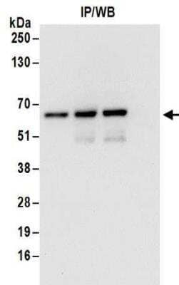 Western Blot: ZNF622 Antibody [NBP2-32102]