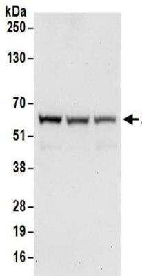 Western Blot: ZNF622 Antibody [NBP2-32103]