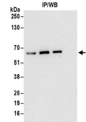 Western Blot: ZNF622 Antibody [NBP2-32103]