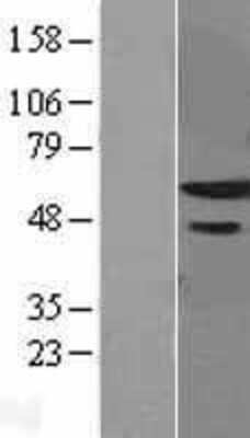 Western Blot: ZNF622 Overexpression Lysate [NBL1-18211]