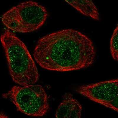 Immunocytochemistry/ Immunofluorescence: ZNF623 Antibody [NBP1-92637]