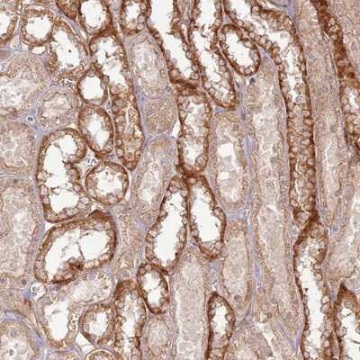 Immunohistochemistry-Paraffin: ZNF623 Antibody [NBP1-92637]