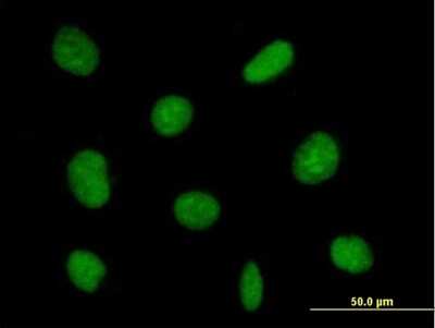 Immunocytochemistry/ Immunofluorescence: ZNF624 Antibody [H00057547-B01P]