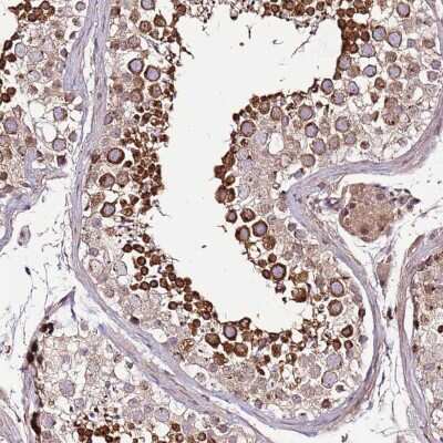 Immunohistochemistry-Paraffin: ZNF624 Antibody [NBP2-48561]