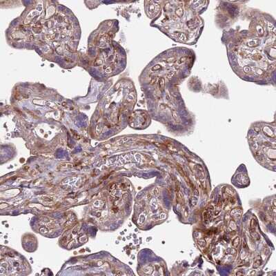 Immunohistochemistry-Paraffin: ZNF624 Antibody [NBP2-48562]