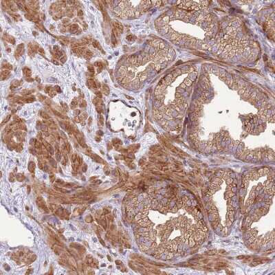 Immunohistochemistry-Paraffin: ZNF624 Antibody [NBP2-48562]