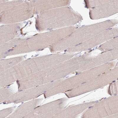 Immunohistochemistry-Paraffin: ZNF624 Antibody [NBP2-48562]