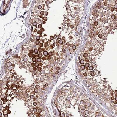 Immunohistochemistry-Paraffin: ZNF624 Antibody [NBP2-48562]